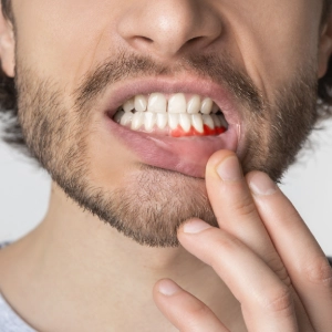 gum disease problem