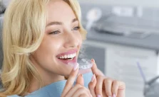 Does insurance cover Invisalign